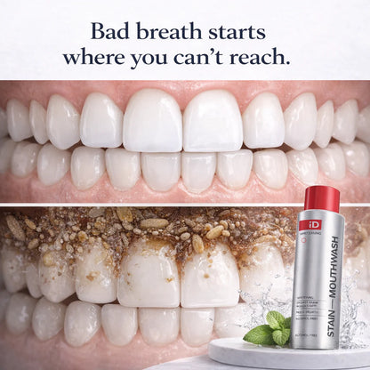Smylux® Breath Freshen & Stain Whitening Mouthwash