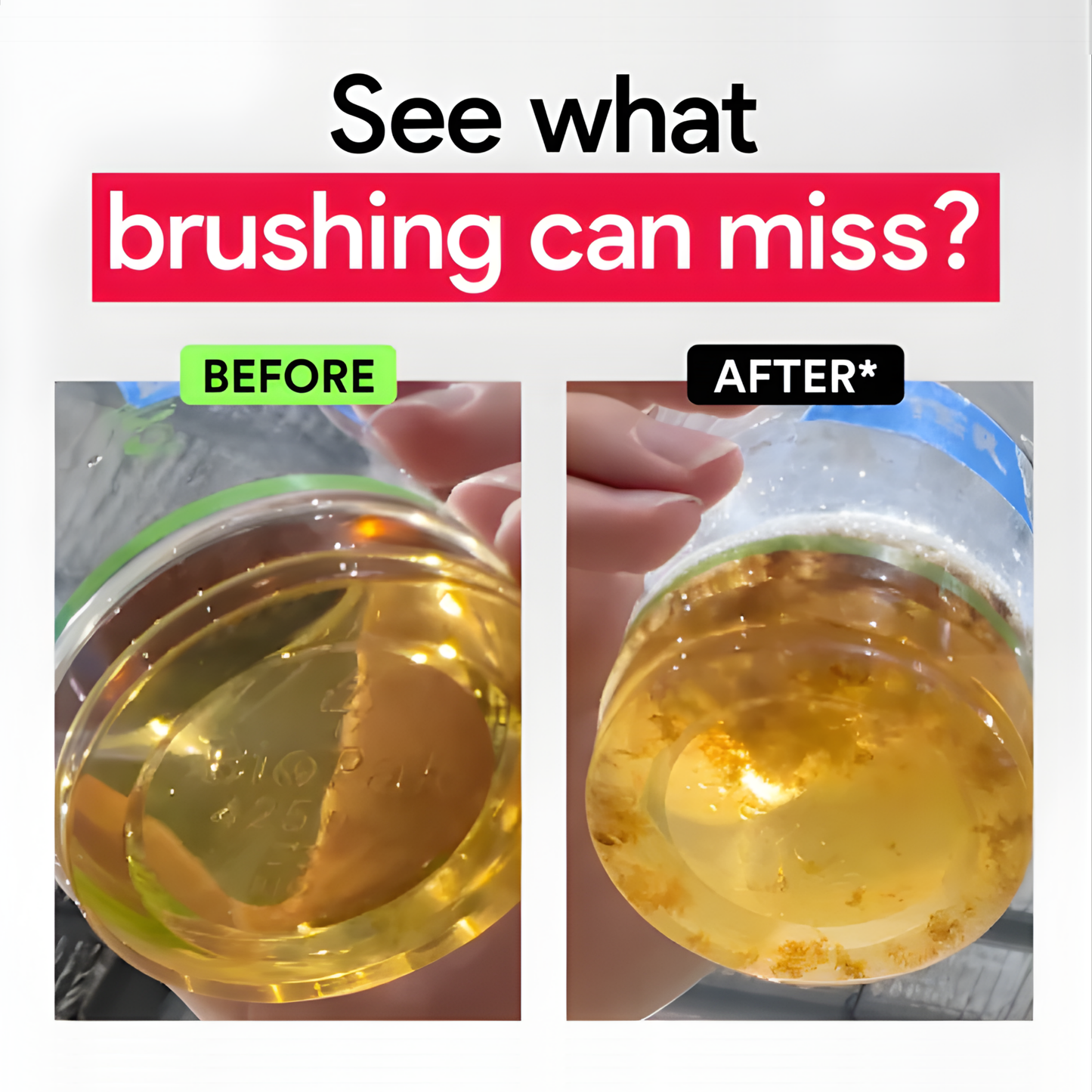 Smylux® Breath Freshen & Stain Whitening Mouthwash